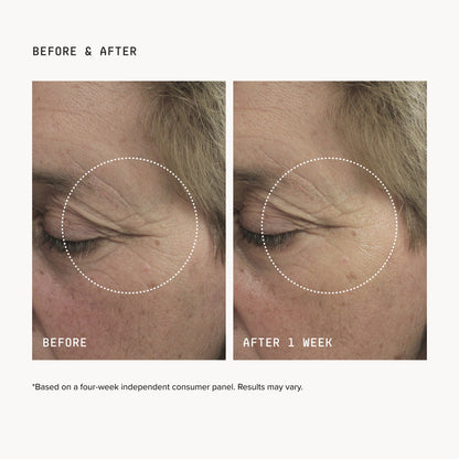 Brightening Eye Masks